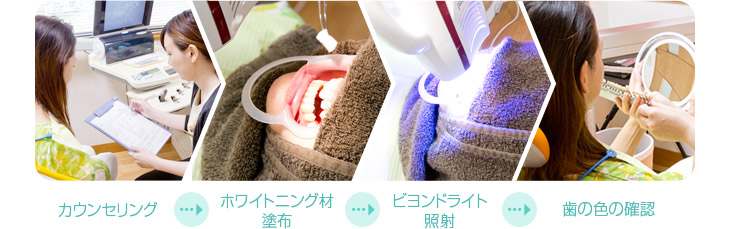 カウンセリング ホワイトニング材塗布 ビヨンドライト照射 歯の色の確認